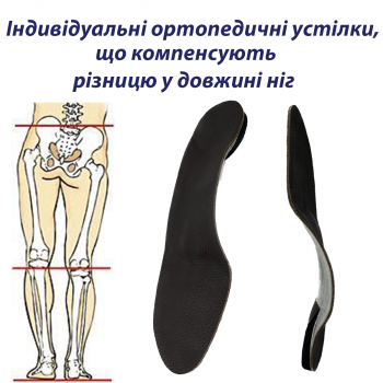Індивідуальні ортопедичні...
